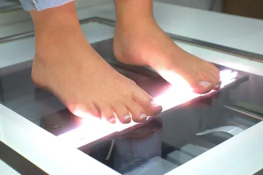 اسکن سه بعدی کف پا