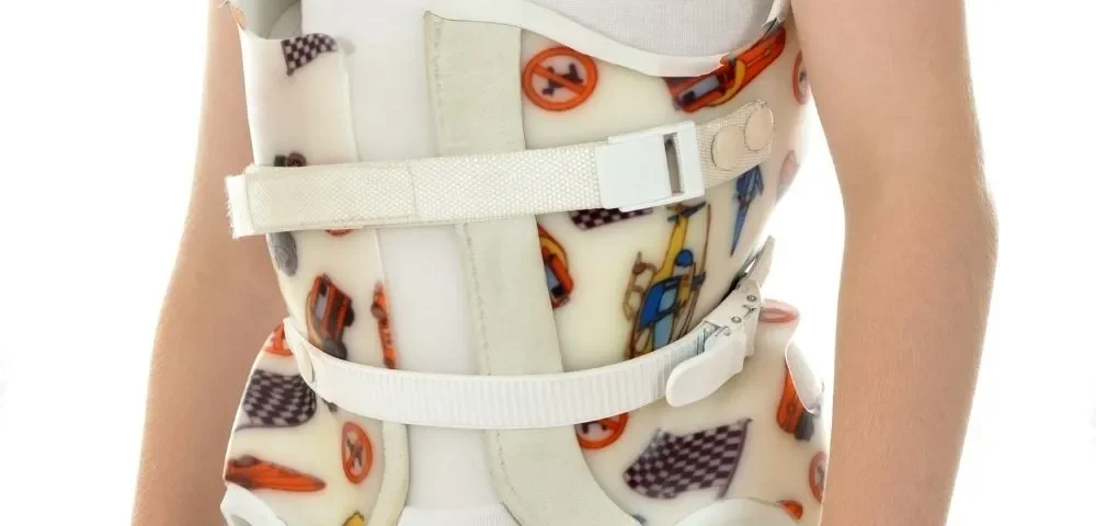 بریس ستون فقرات برای اسکولیوز