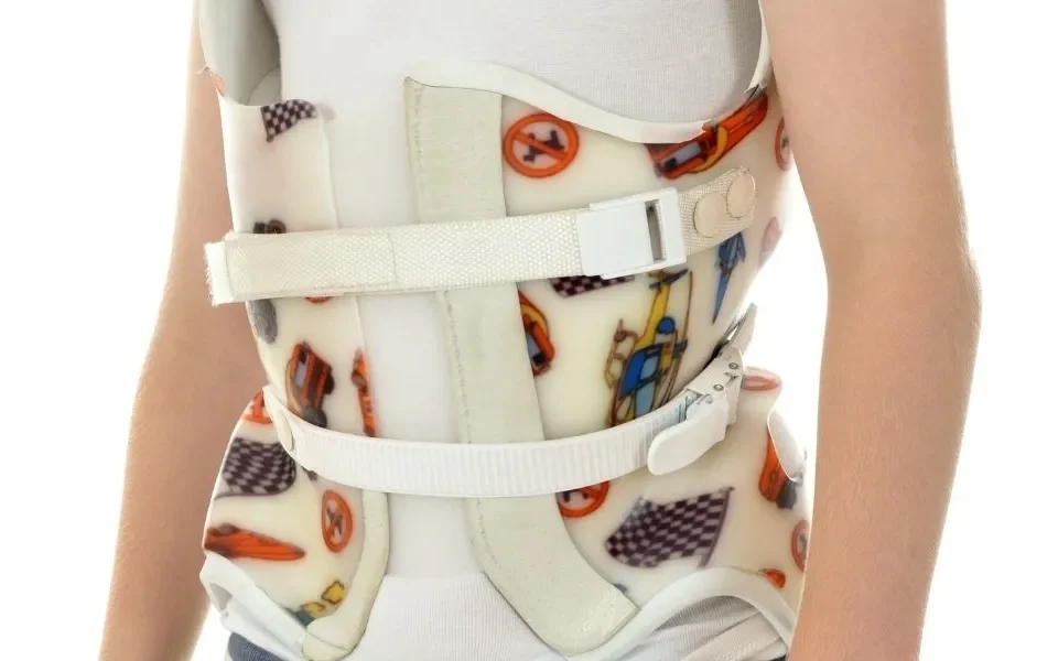 بریس ستون فقرات برای اسکولیوز