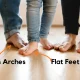 قوس زیاد کف پا