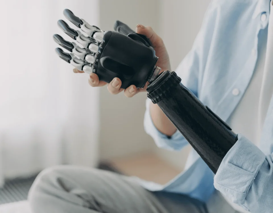 پروتز مایو الکتریک