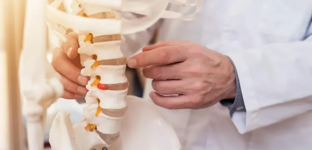 انحراف ستون فقرات