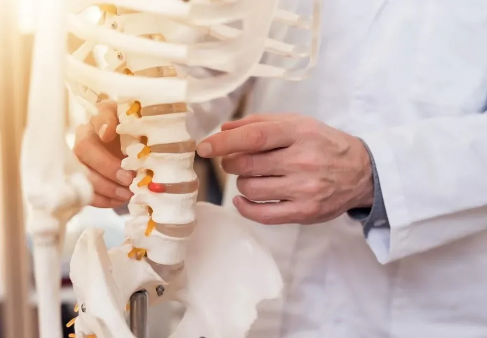 انحراف ستون فقرات